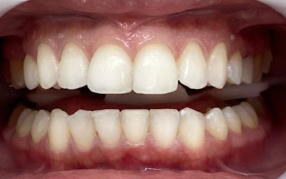 Sorriso com dentes claros e alinhados
